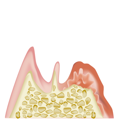 real-teeth008